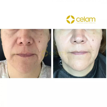 Slider image (6) CELAM Centro Laser Medico for Aesthetic Wellness